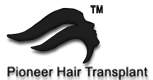 Hair Transplant