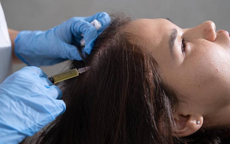 Benefits of PRP Hair Therapy for Hair Growth in Riyadh