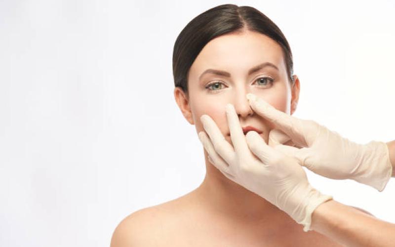 Rhinoplasty for Correcting Nasal Irregularities and Contours
