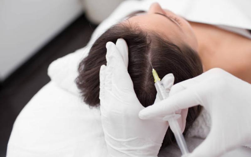 PRP Hair Treatment Timeline: Expectations for Gradual Hair Density Changes
